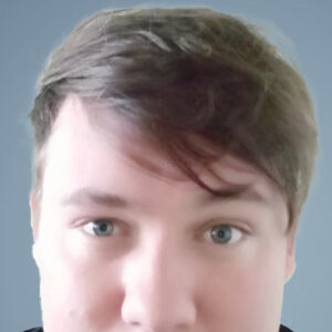hair transplant cost London