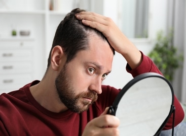 DHI Hair Transplant 1