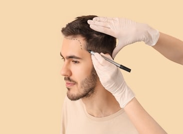 Male Hair Loss Treatment Liverpool