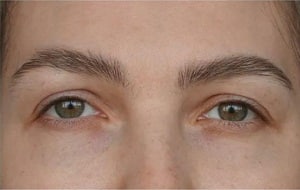 eyebrow restoration liverpool