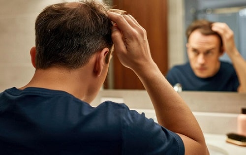 hair restoration with flexible finance