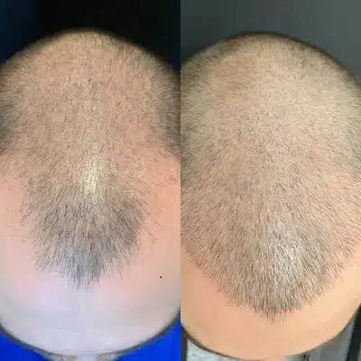 B&A CLOSE UP