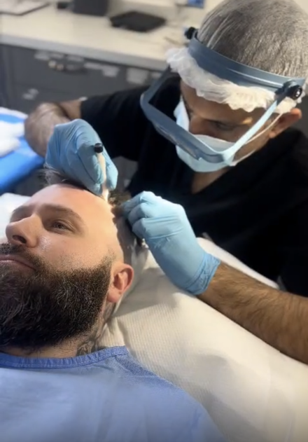 Hair transplant patient in action at the royal liver building