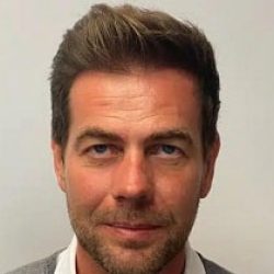 hair transplant in liverpool